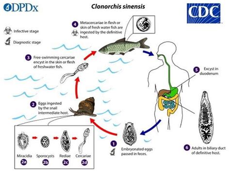   Clonorchis sinensis: A Tiny Liver Fluke That Can Pack a Punch, Causing Painful Bile Duct Infections!