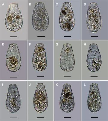  Quadrulella:  A Microscopic Masterpiece of Shape-Shifting and Delicate Feeding!